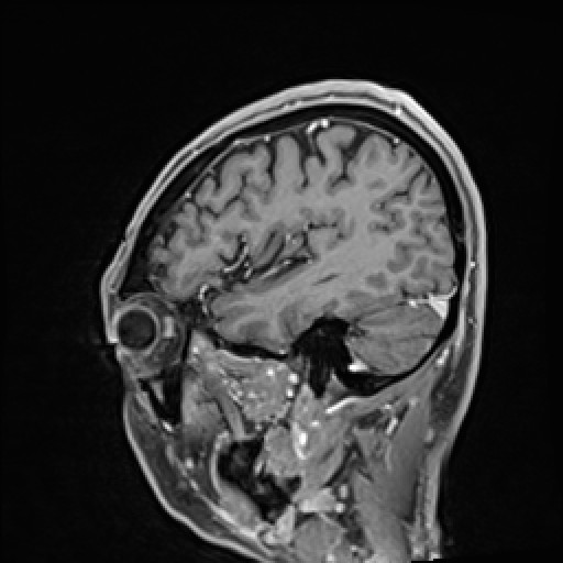 Click on the Serie image to view the images of VILLANUEVA, WILLIAM A.